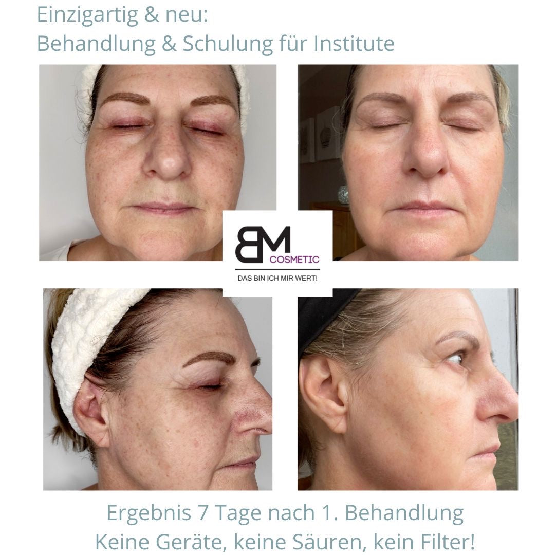 SQT Biomicroneedling großes Starterset inkl. Online Schulung